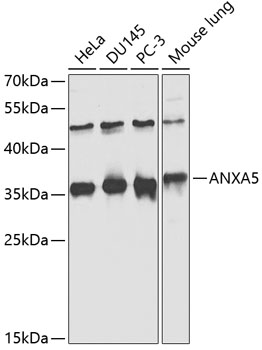 ANXA5 Polyclonal Antibody (50 µl)