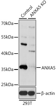 ANXA5 Polyclonal Antibody (100 µl)