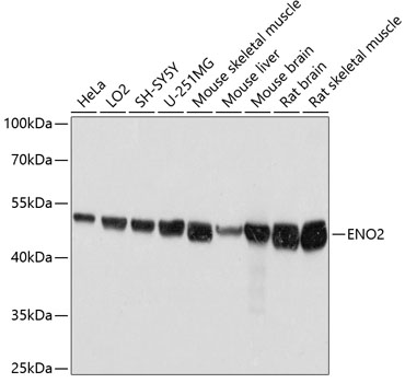 ENO2 Polyclonal Antibody (50 µl)