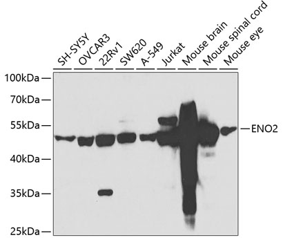 ENO2 Polyclonal Antibody (100 µl)