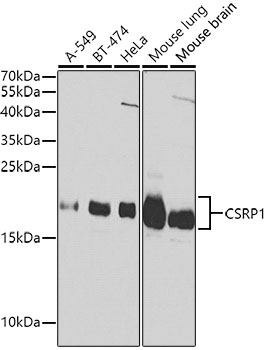 CSRP1 Polyclonal Antibody (100 µl)