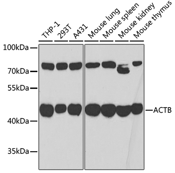 ACTB Polyclonal Antibody (100 µl)
