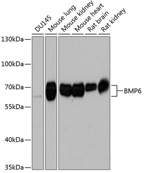 BMP6 Polyclonal Antibody (100 µl)