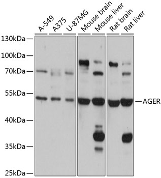 AGER Polyclonal Antibody (100 µl)