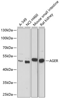 AGER Polyclonal Antibody (50 µl)