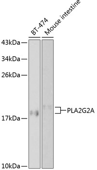 PLA2G2A Polyclonal Antibody