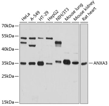 ANXA3 Polyclonal Antibody (100 µl)
