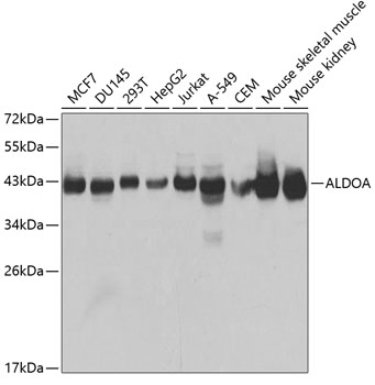ALDOA Polyclonal Antibody (100 µl)