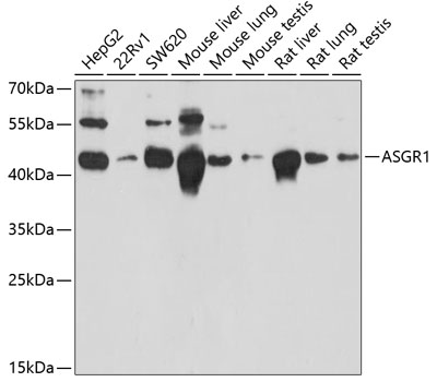 ASGR1 Polyclonal Antibody (100 µl)