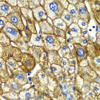 ASGR1 Polyclonal Antibody (50 µl)