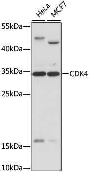 CDK4 Polyclonal Antibody (50 µl)