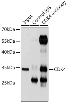 CDK4 Polyclonal Antibody (100 µl)