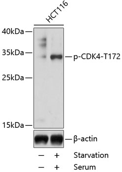 Phospho-CDK4-T172 Polyclonal Antibody (50 µl)