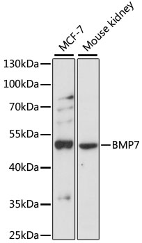 BMP7 Polyclonal Antibody (50 µl)