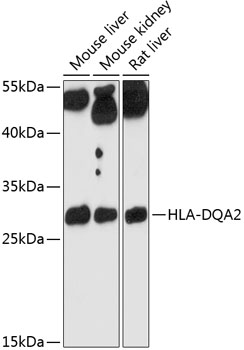 HLA-DQA2 Polyclonal Antibody (50 µl)