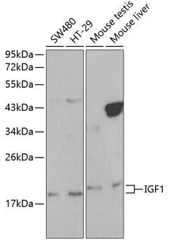 IGF1 Polyclonal Antibody (100 µl)