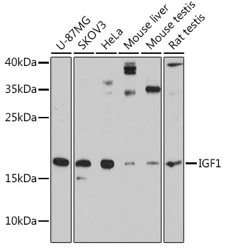 IGF1 Polyclonal Antibody (50 µl)