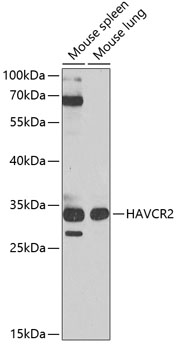 HAVCR2 Polyclonal Antibody (100 µl)