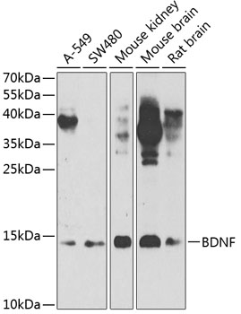 BDNF Polyclonal Antibody (100 µl)