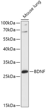 BDNF Polyclonal Antibody (50 µl)