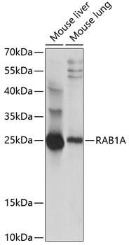 RAB1A Polyclonal Antibody