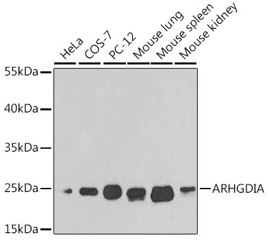 ARHGDIA Polyclonal Antibody (100 µl)