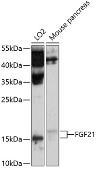 FGF21 Polyclonal Antibody (50 µl)
