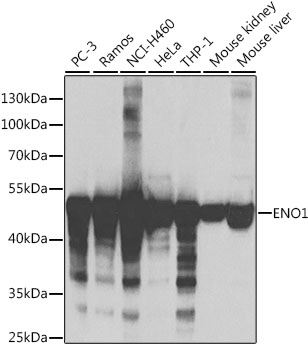 ENO1 Polyclonal Antibody (50 µl)