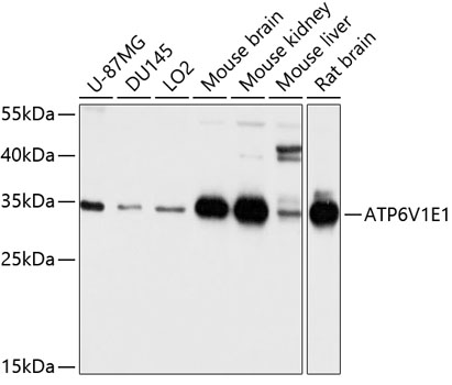 ATP6V1E1 Polyclonal Antibody (50 µl)