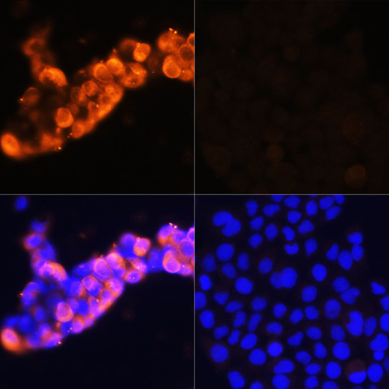 AFP Polyclonal Antibody (100 µl)