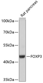 FOXP3 Polyclonal Antibody (50 µl)