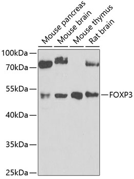 FOXP3 Polyclonal Antibody (100 µl)