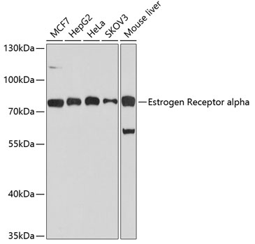 Estrogen Receptor alpha Polyclonal Antibody (50 µl)