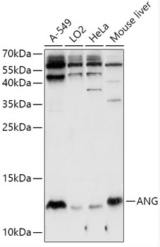 ANG Polyclonal Antibody (50 µl)