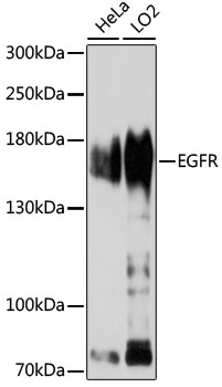 EGFR Polyclonal Antibody (100 µl)