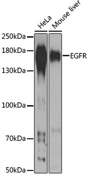 EGFR Polyclonal Antibody (100 µl)