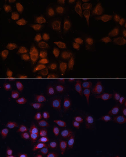 ADAM15 Polyclonal Antibody (100 µl)