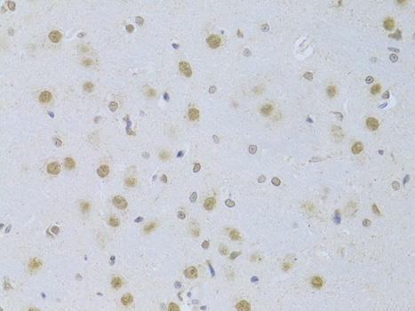 CDKN1A Polyclonal Antibody (100 µl)