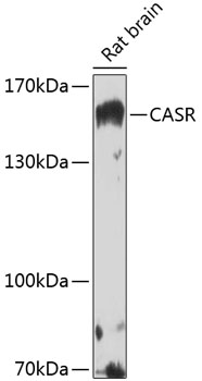 CASR Polyclonal Antibody (50 µl)