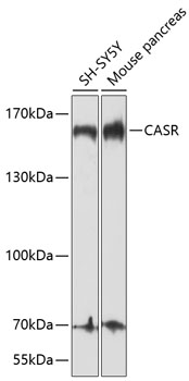 CASR Polyclonal Antibody (100 µl)