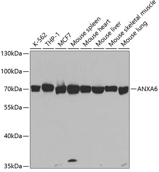 ANXA6 Polyclonal Antibody (100 µl)