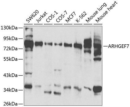 ARHGEF7 Polyclonal Antibody (50 µl)