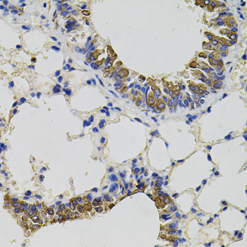 CD59 Polyclonal Antibody (100 µl)
