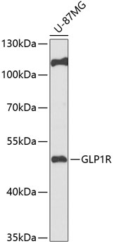 GLP1R Polyclonal Antibody (50 µl)