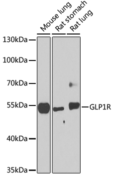 GLP1R Polyclonal Antibody (100 µl)