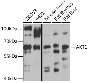 AKT1 Polyclonal Antibody (50 µl)