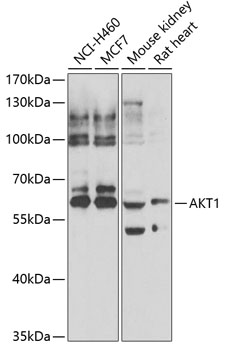 AKT1 Polyclonal Antibody (100 µl)
