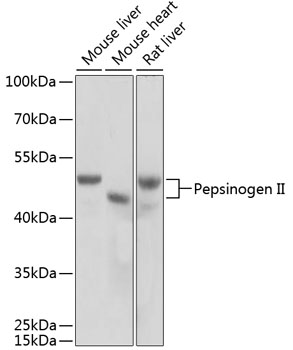 Pepsinogen II Polyclonal Antibody