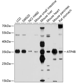 ATP4B Polyclonal Antibody (50 µl)