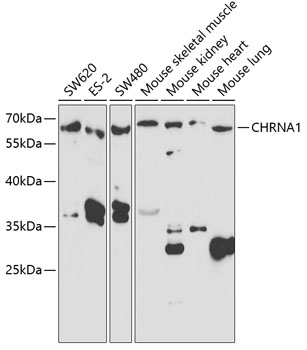 CHRNA1 Polyclonal Antibody (50 µl)